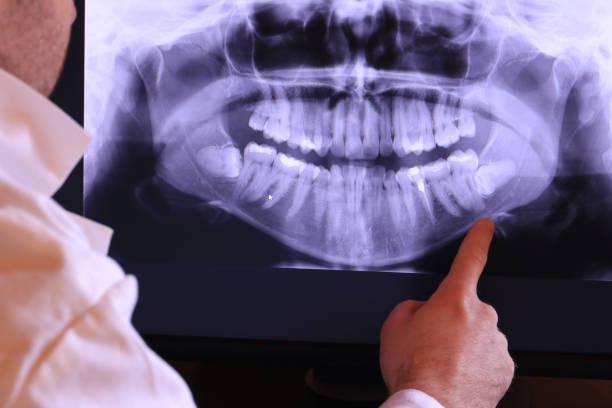 Best Emergency Dentist for Lost Fillings or Crowns in Chevy Chase View, MD