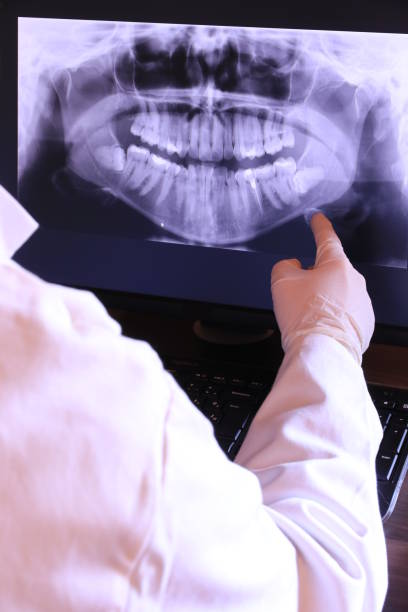 Best Emergency Dental Care for Abscessed Tooth in Chevy Chase View, MD