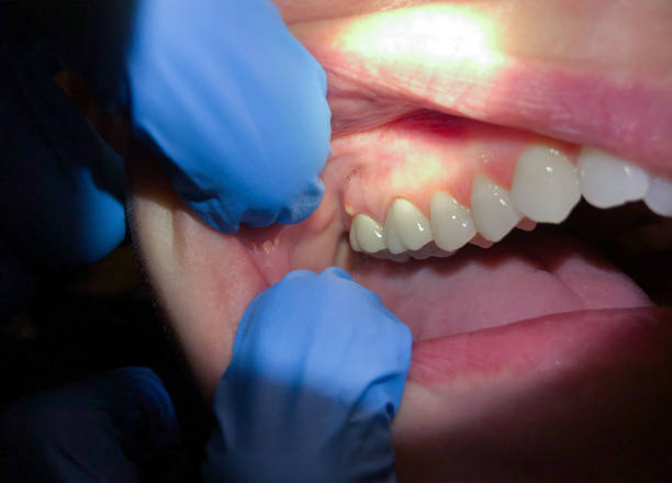 Best Emergency Dentist for Special Needs Patients in Chevy Chase View, MD