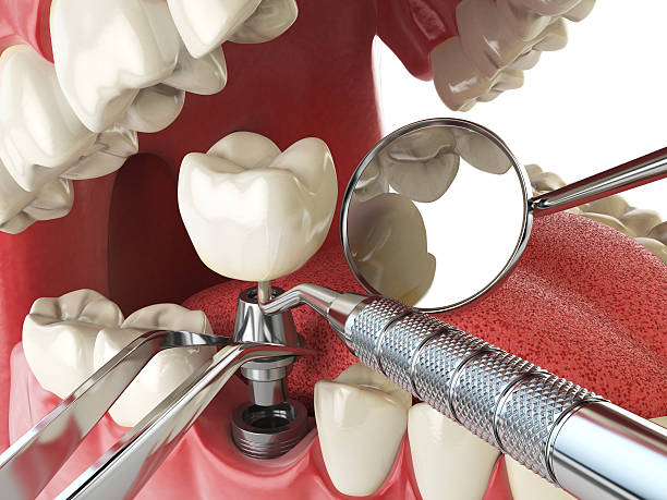 Best Pediatric Emergency Dentist in Chevy Chase View, MD