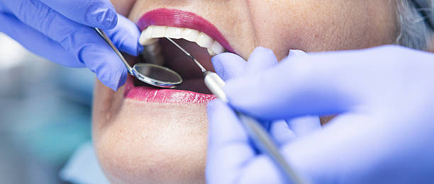 Best Emergency Root Canal Treatment in Chevy Chase View, MD